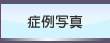 症例紹介